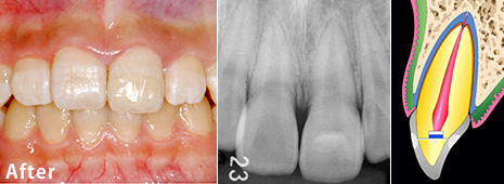 �����j�܂̎��×�@����1�@�p��