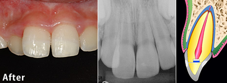 �����j�܂̎��×�@����2�@�p��