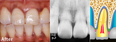 �����j�܂̎��×�@�p��