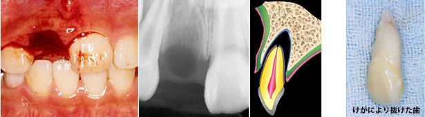 �����ɂ��E�����̎��×�