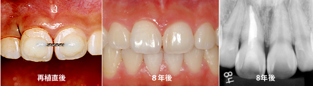 �ĐA��̌o��