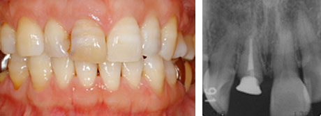 �C���v�����g���Â̗���