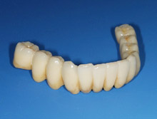 �Œ莮�̃u���b�W