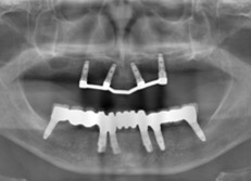 �p�m���}�G�b�N�X���ʐ^